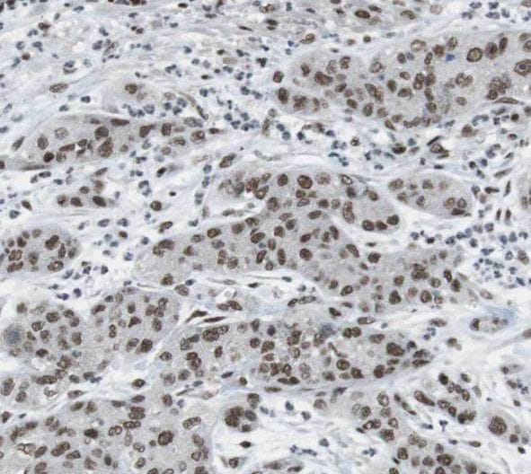 THADA Antibody - BSA Free