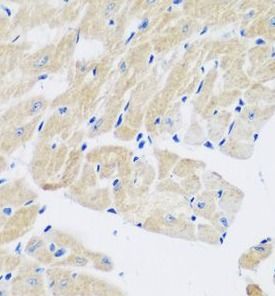 Transglutaminase 5 Antibody - BSA Free