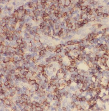 TFPT Antibody - BSA Free