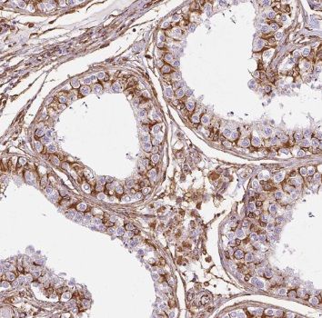 Testis expressed 38 Antibody - BSA Free