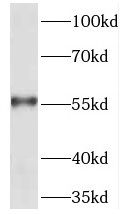 TEKT5 Antibody - BSA Free