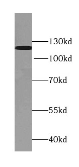 TDRD5 Antibody - BSA Free