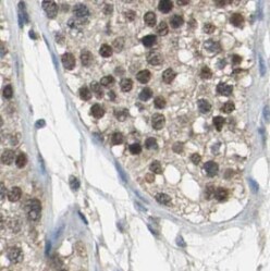 TDRD5 Antibody - BSA Free