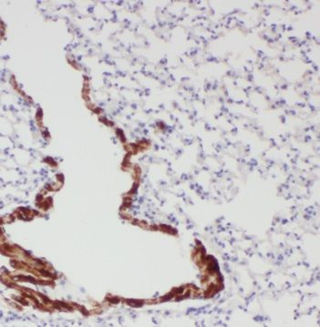 TCTN3 Antibody - BSA Free