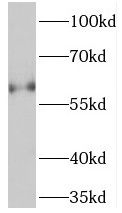 TCHP Antibody - BSA Free