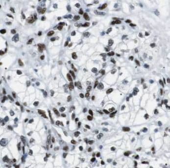 Elongin A Antibody - BSA Free