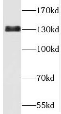 TBCD Antibody - BSA Free