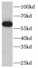TBC1D24 Antibody - BSA Free