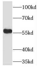 ADA2 beta Antibody - BSA Free