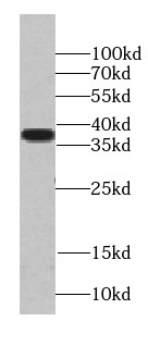 TADA1L Antibody - BSA Free
