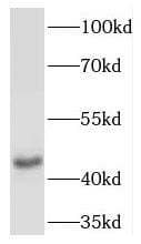 NK2R Antibody - BSA Free