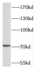 TACC2 Antibody - BSA Free