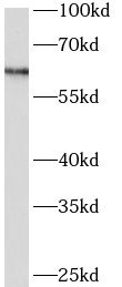 Arylsulfatase D Antibody - BSA Free