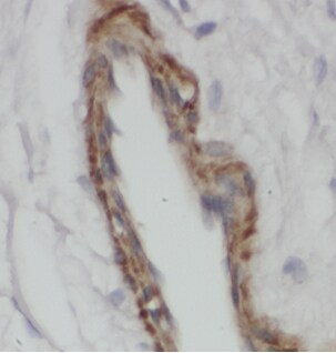 Arylsulfatase D Antibody - BSA Free