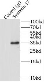 STX17 Antibody - BSA Free