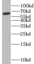 SLC38A1 Antibody - BSA Free