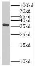SLC25A33 Antibody - BSA Free