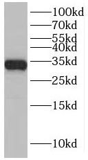 SLC25A22 Antibody - BSA Free