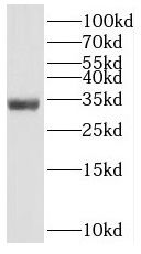 SLC25A2 Antibody - BSA Free