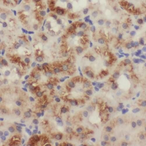 SLC25A1 Antibody - BSA Free