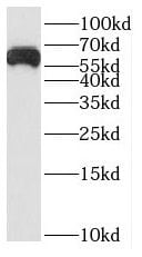 SLC24A6 Antibody - BSA Free