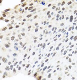 SKIV2L2 Antibody - BSA Free