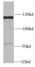 SKIV2L2 Antibody - BSA Free