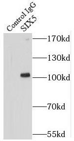SIX5 Antibody - BSA Free
