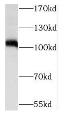 SIX5 Antibody - BSA Free