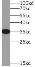 SIX2 Antibody - BSA Free