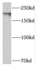 SIPA1L1 Antibody - BSA Free