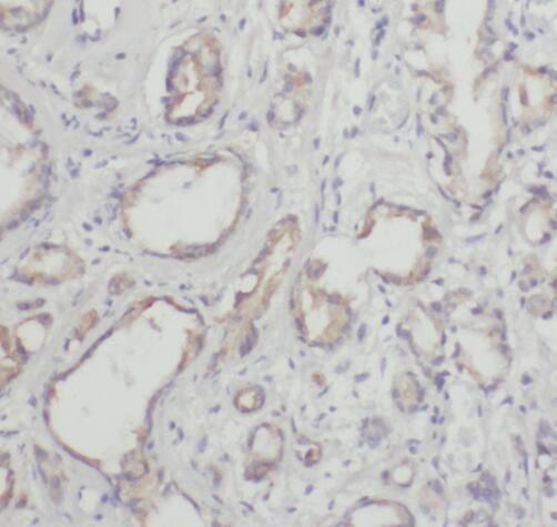 CARKL Antibody - BSA Free