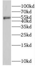 CARKL Antibody - BSA Free