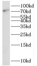 SHCBP1 Antibody - BSA Free