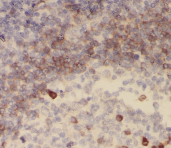 SHCBP1 Antibody - BSA Free