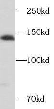 SH3PXD2A Antibody - BSA Free