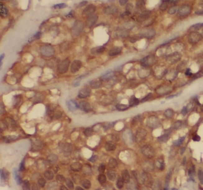 SH3PXD2A Antibody - BSA Free