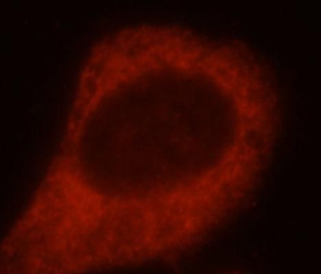 SH3PXD2A Antibody - BSA Free