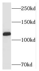 SH3BP4 Antibody - BSA Free