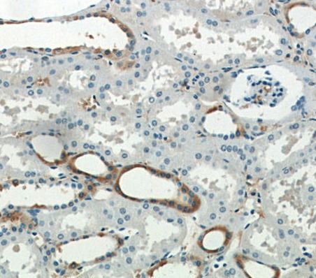 SGLT3/SLC5A4 Antibody - BSA Free