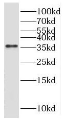 gamma Sarcoglycan Antibody - BSA Free