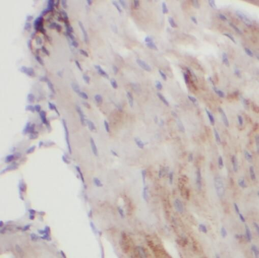 gamma Sarcoglycan Antibody - BSA Free