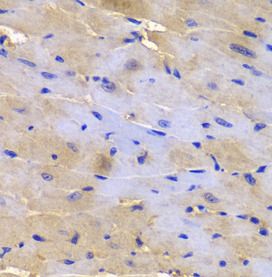 epsilon-Sarcoglycan Antibody - BSA Free