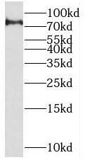 SETMAR Antibody - BSA Free