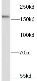 SETBP1 Antibody - BSA Free