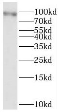 SERCA3 ATPase Antibody - BSA Free