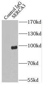 SERCA3 ATPase Antibody - BSA Free