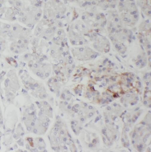 SERCA3 ATPase Antibody - BSA Free
