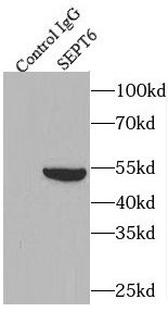 Septin-6 Antibody - BSA Free