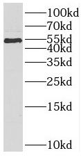 Secretin R Antibody - BSA Free